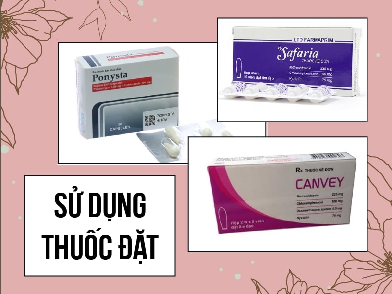 Sử dụng thuốc đặt điều trị huyết trắng là phương pháp hiệu quả nhất