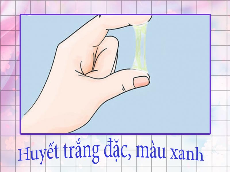 Huyết trắng đặc quánh, màu xanh