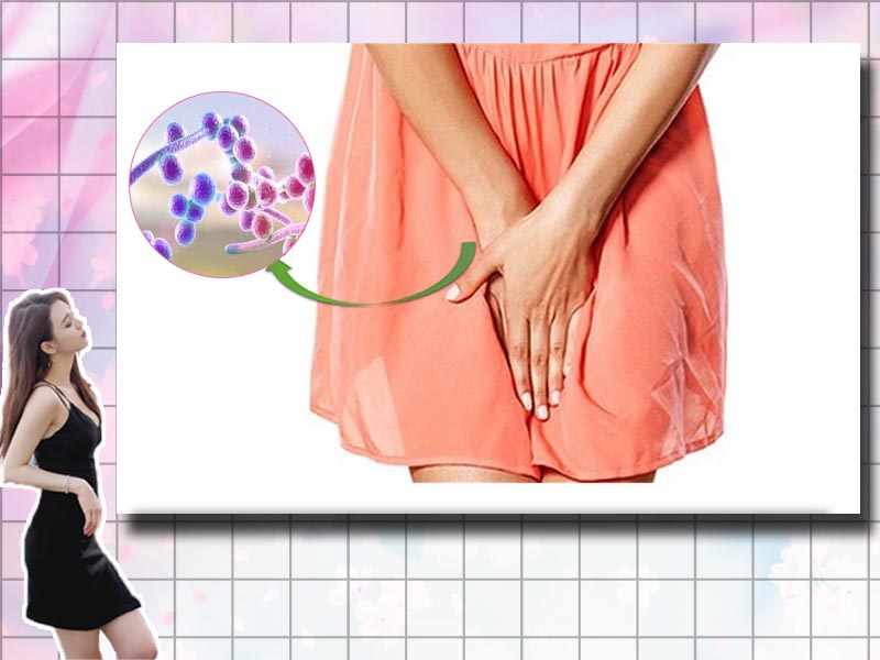Nhiễm nấm Candida âm đạo
