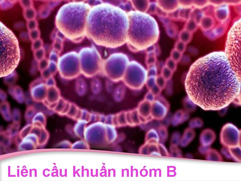 Liên cầu khuẩn nhóm B