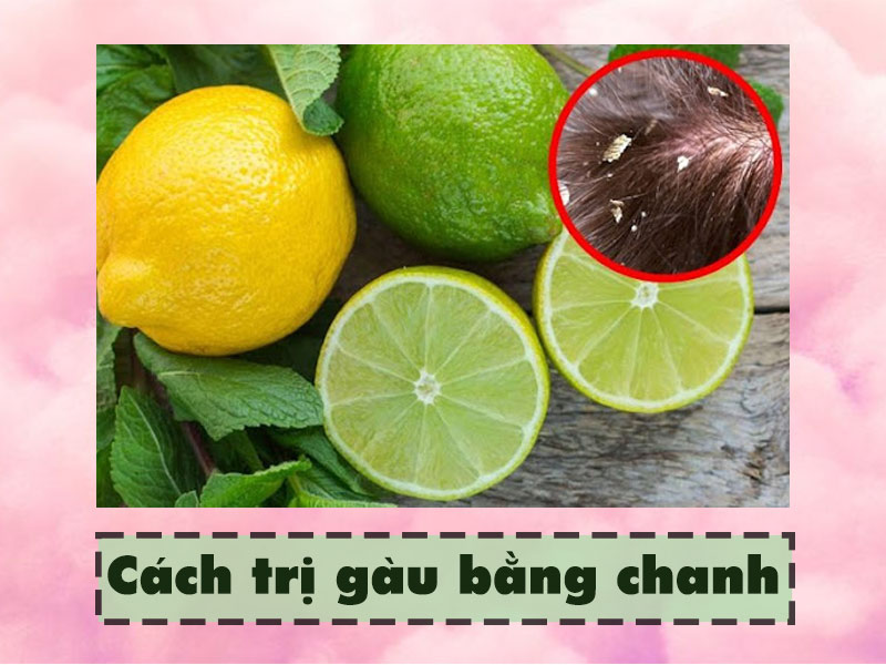 Cách trị gàu bằng chanh