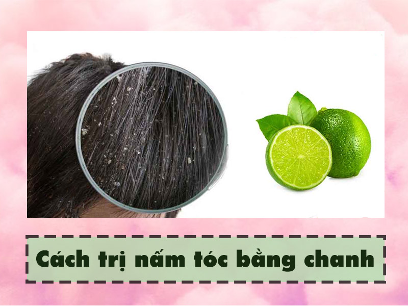 Mẹo trị nấm tóc bằng chanh tươi