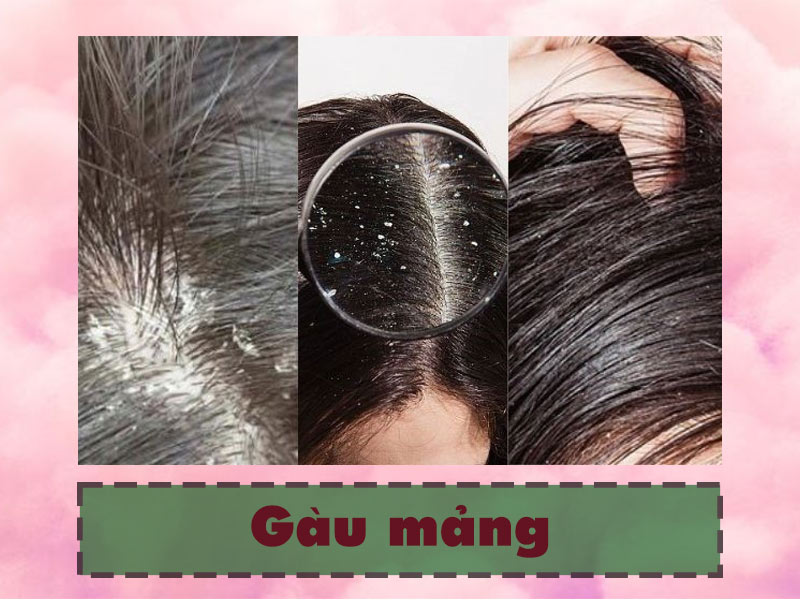 Gàu mảng là gì