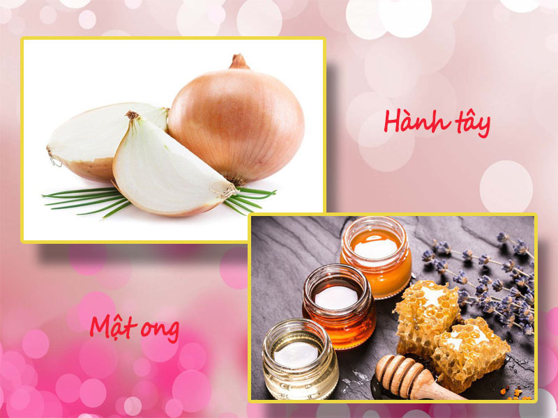 Mật ong và hành tây kích thích mọc tóc