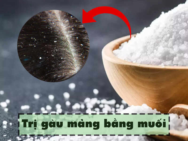 Trị gàu mảng bằng muối