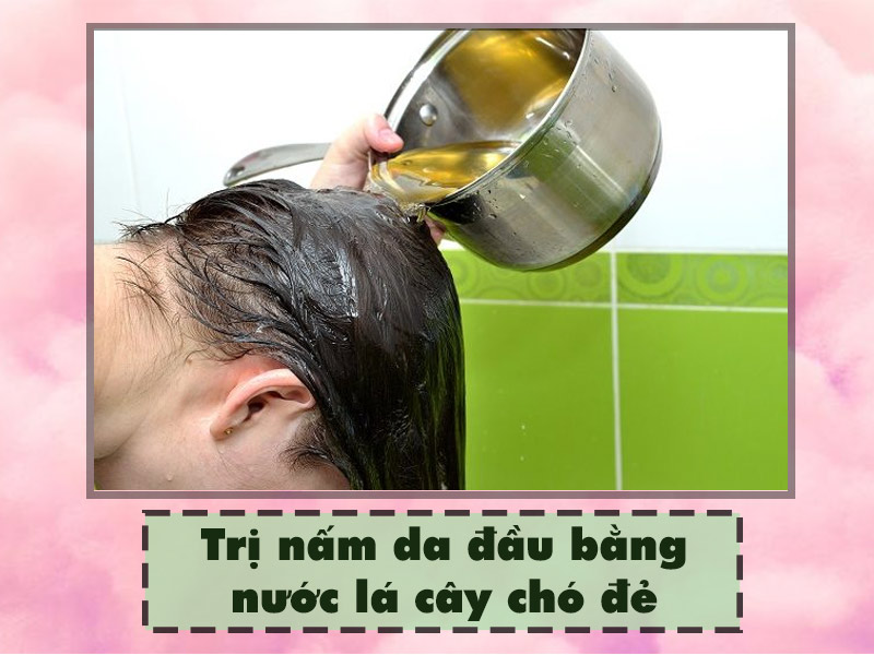 Trị nấm da đầu bằng nước lá cây chó đẻ