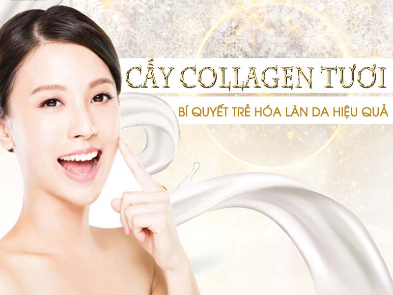 cấy tinh chất collagen