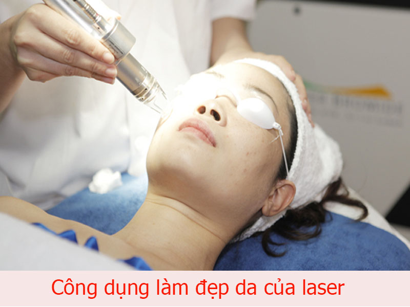 công dụng của laser