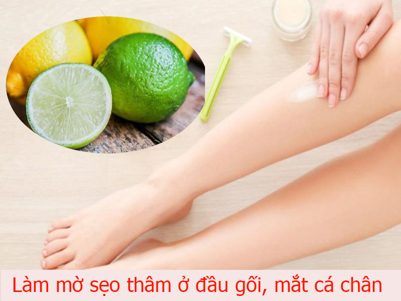 Chanh giúp làm mờ sẹo thâm ở đầu gối mắt cá chân