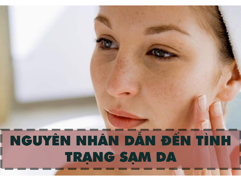 Nguyên nhân khiến cho da bị sạm màu