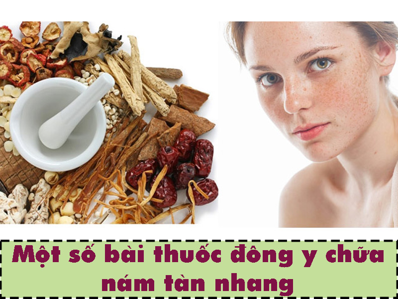 Một số bài thuốc chữa nám tàn nhang từ đông y