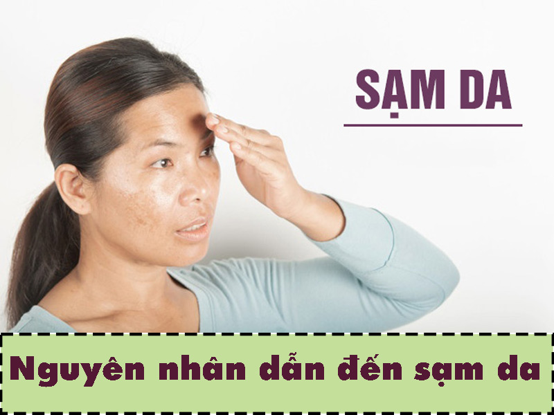 Nguyên nhân dẫn đến hiện tượng da sạm màu