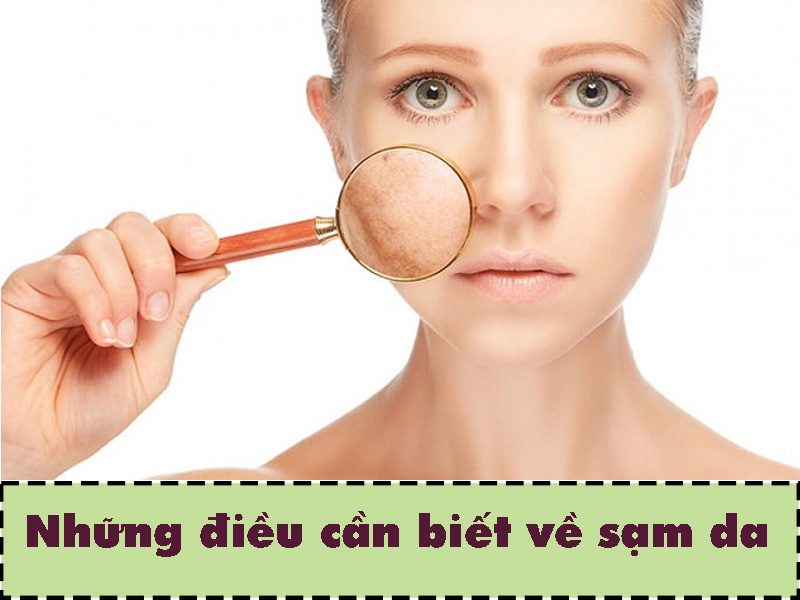 Một số điều cần biết về sạm da