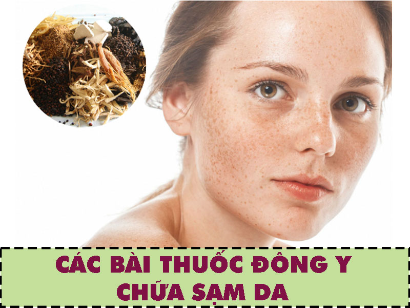 Chữa sạm da bằng phương pháp đông y